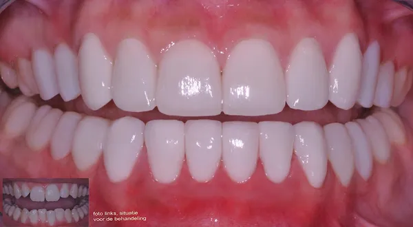 Amsterdam_Dentists_row_168