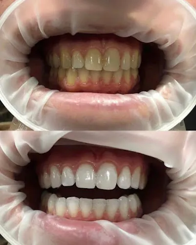 Amsterdam_Dentists_row_63