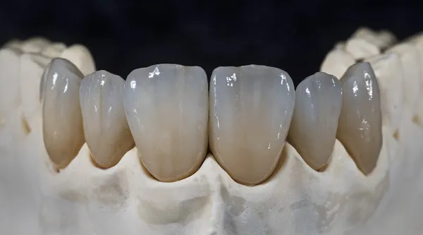 Amsterdam_Dentists_row_73