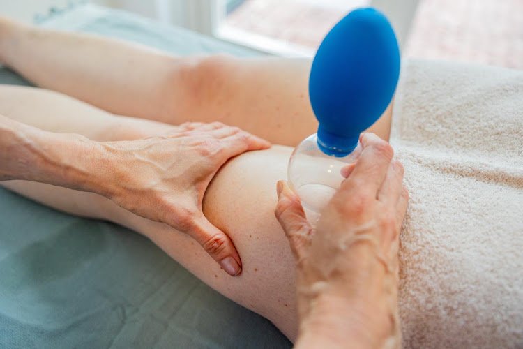 Bodycarebyme Cupping