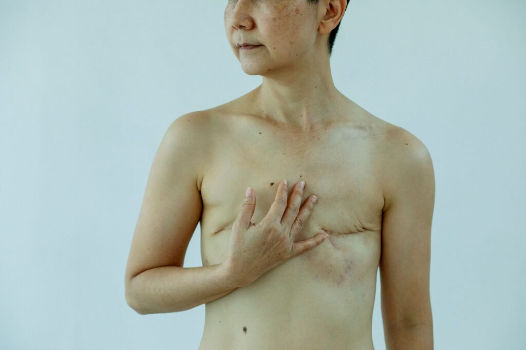 Human Water: portraits on mastectomy and body sovereignty